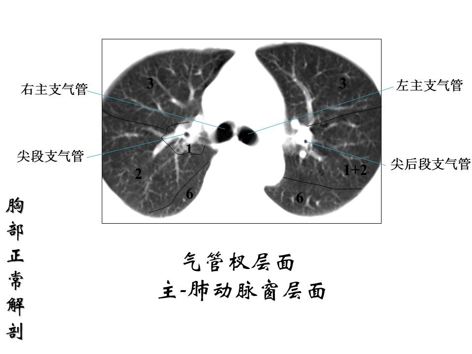 幻灯片56