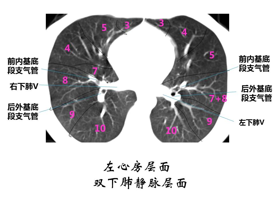 幻灯片66