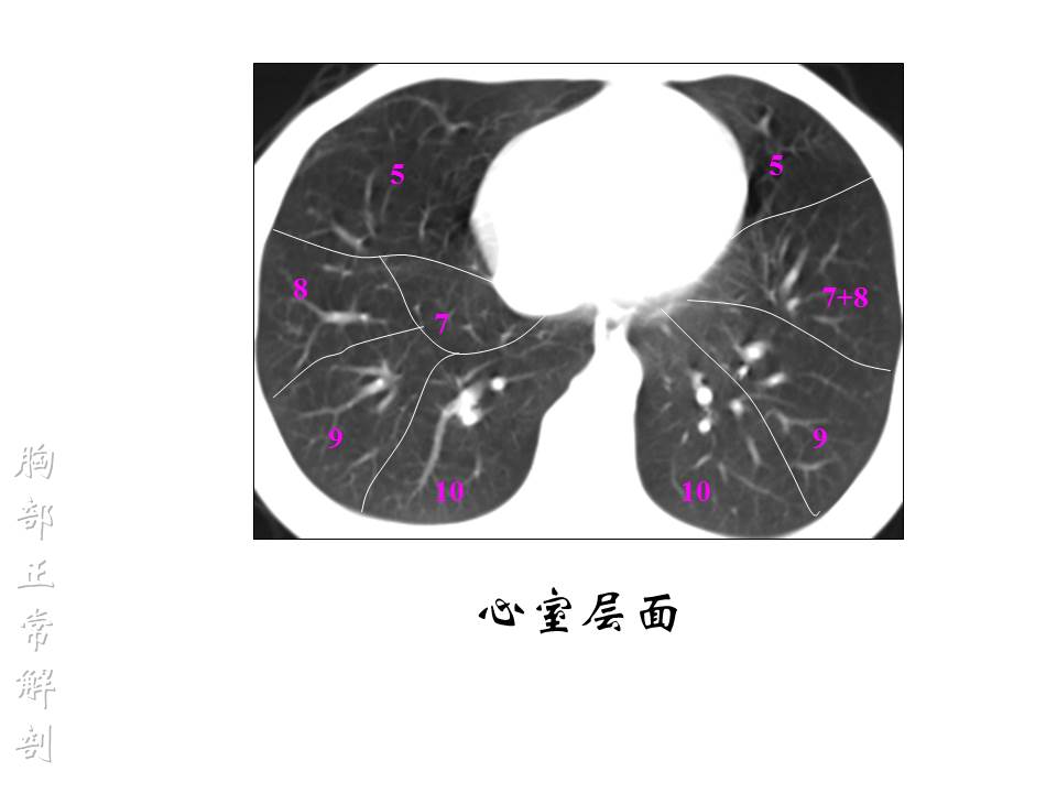 幻灯片70