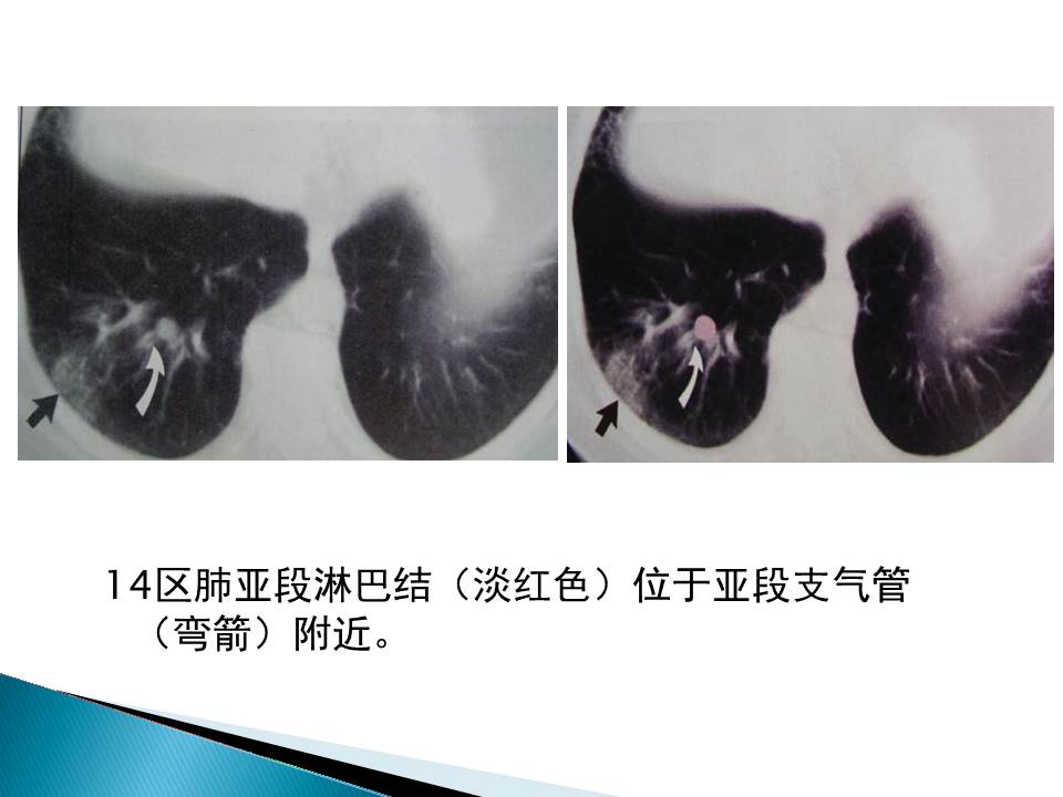 幻灯片92