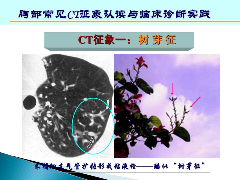 幻灯片96
