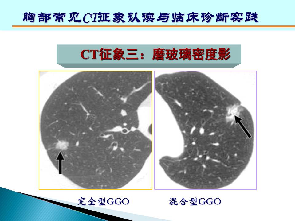 幻灯片113