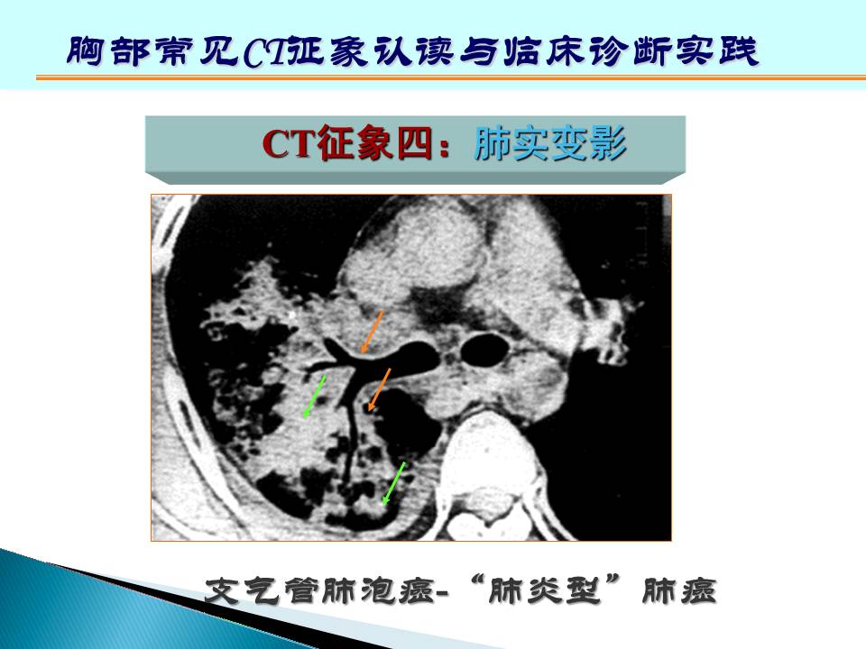 幻灯片123