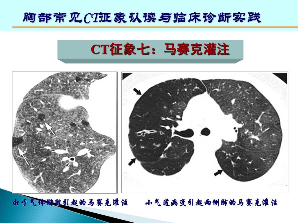 幻灯片139