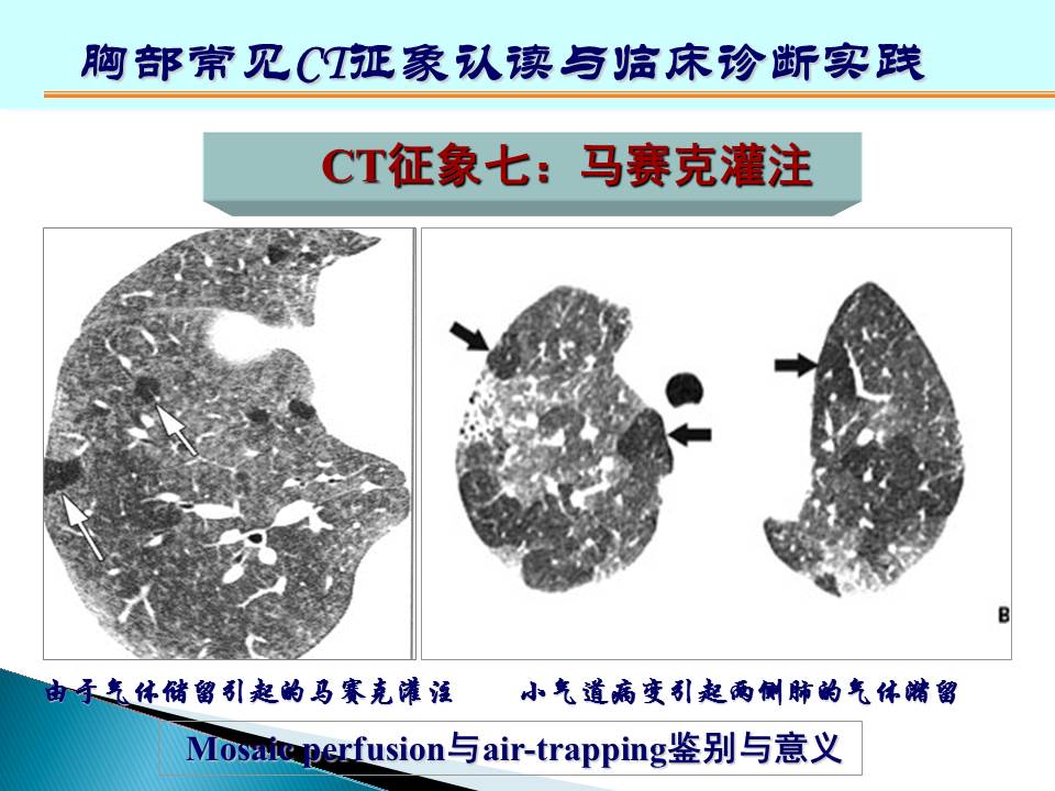 幻灯片140