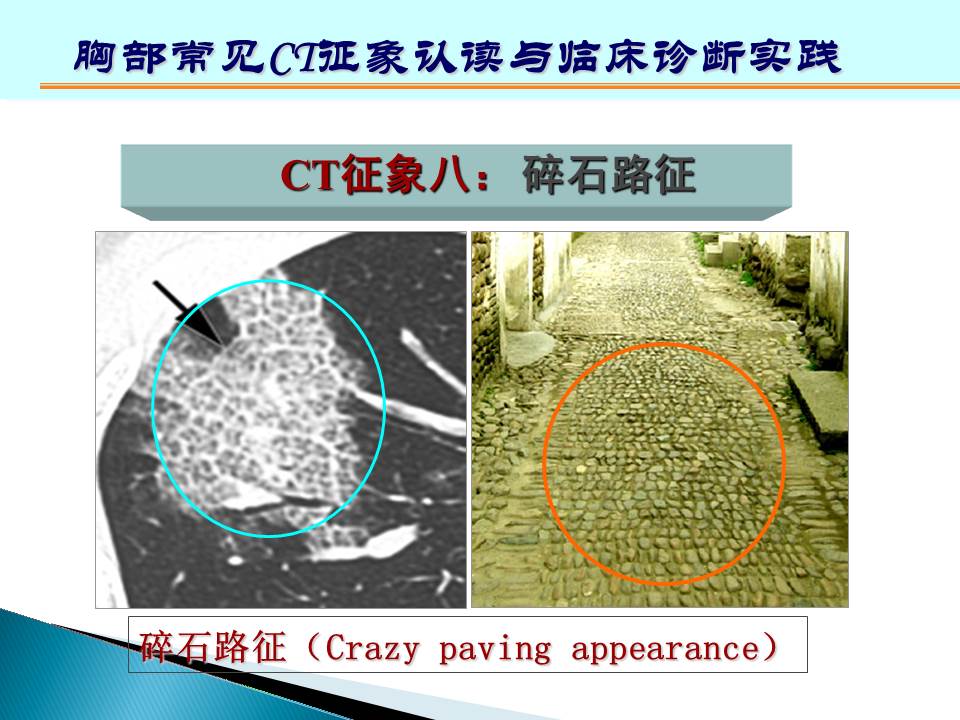 幻灯片142