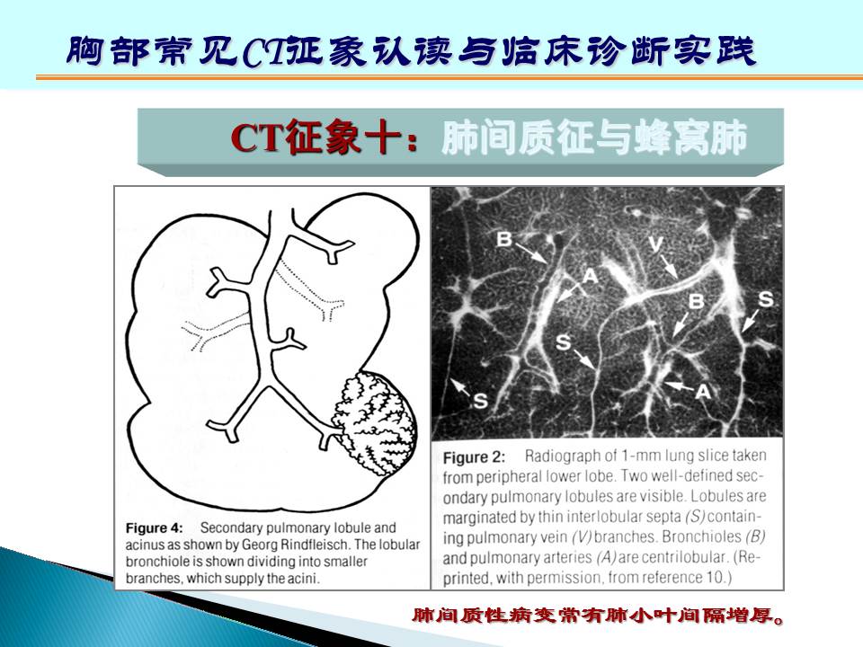幻灯片153