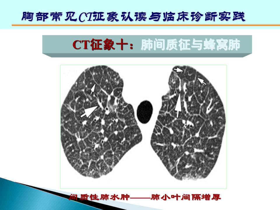 幻灯片154