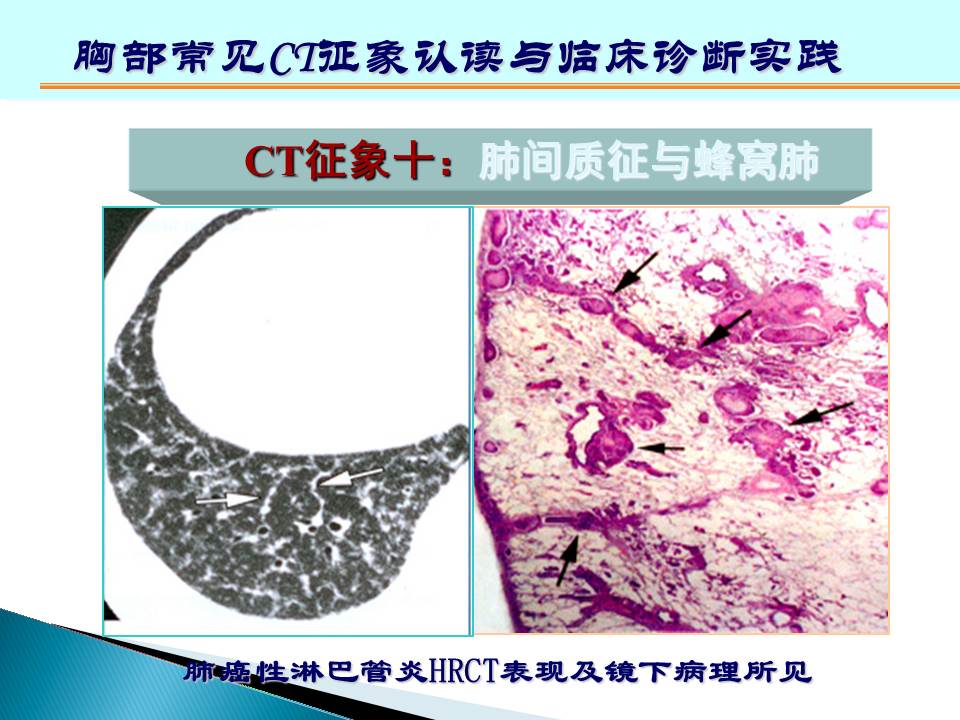 幻灯片155