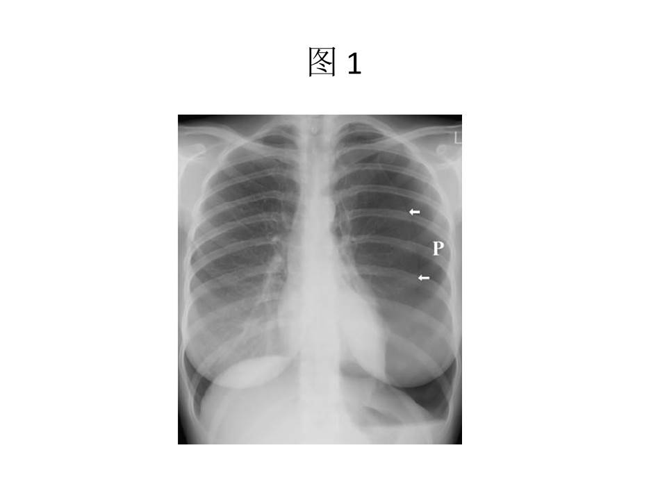 幻灯片4