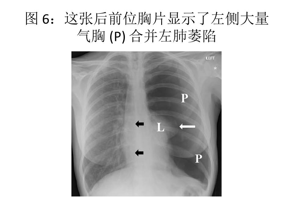 幻灯片15