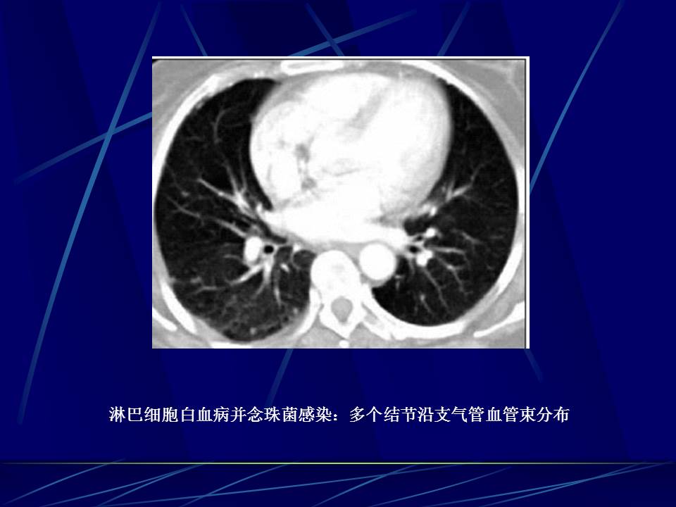 幻灯片20