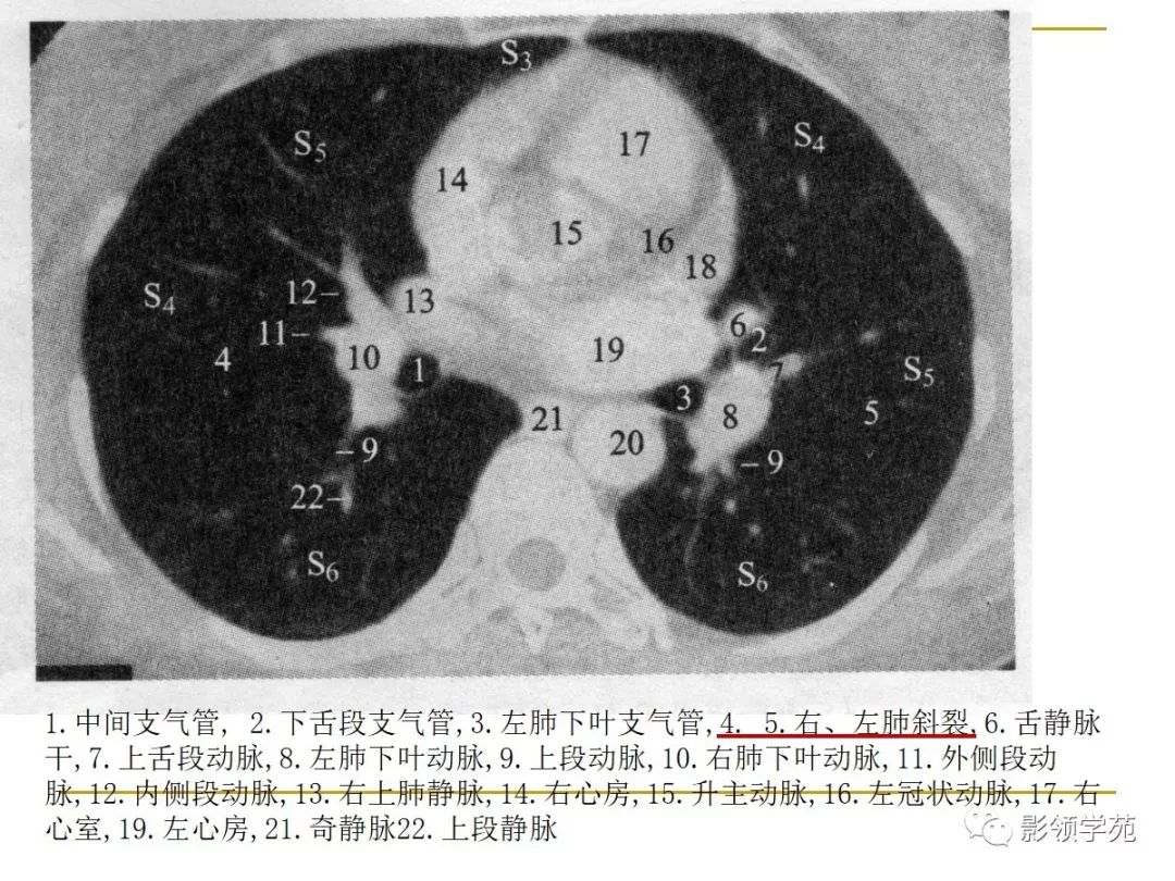 肺段与肺内管道应用解剖
