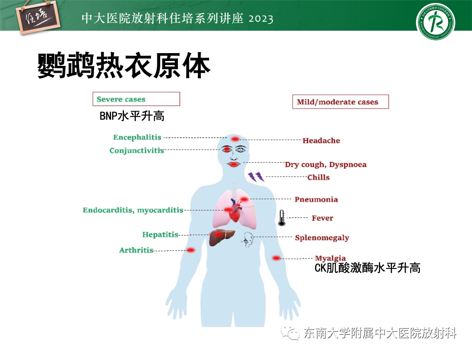 肺部特殊感染影像分析-21