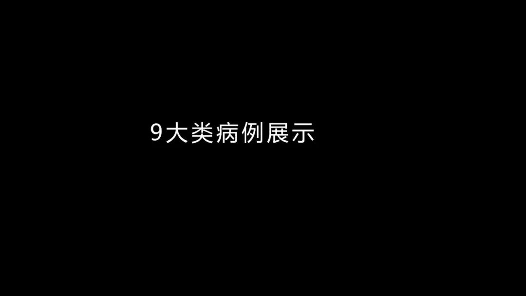 【PPT】肺部CT高密度病变诊断思路-22