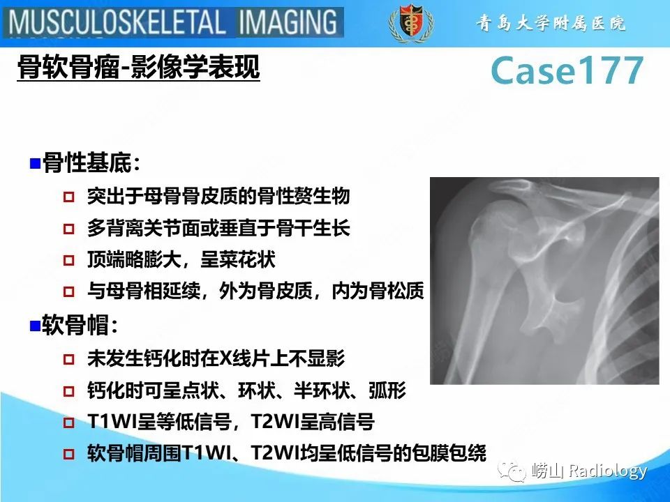 【PPT】骨软骨瘤-恶变-7