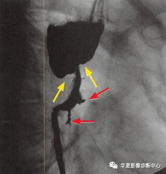 一定要小心食管的\