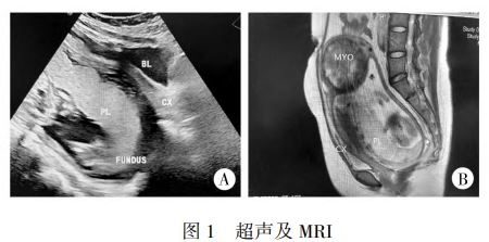 点击查看原图 捕获1.JPG