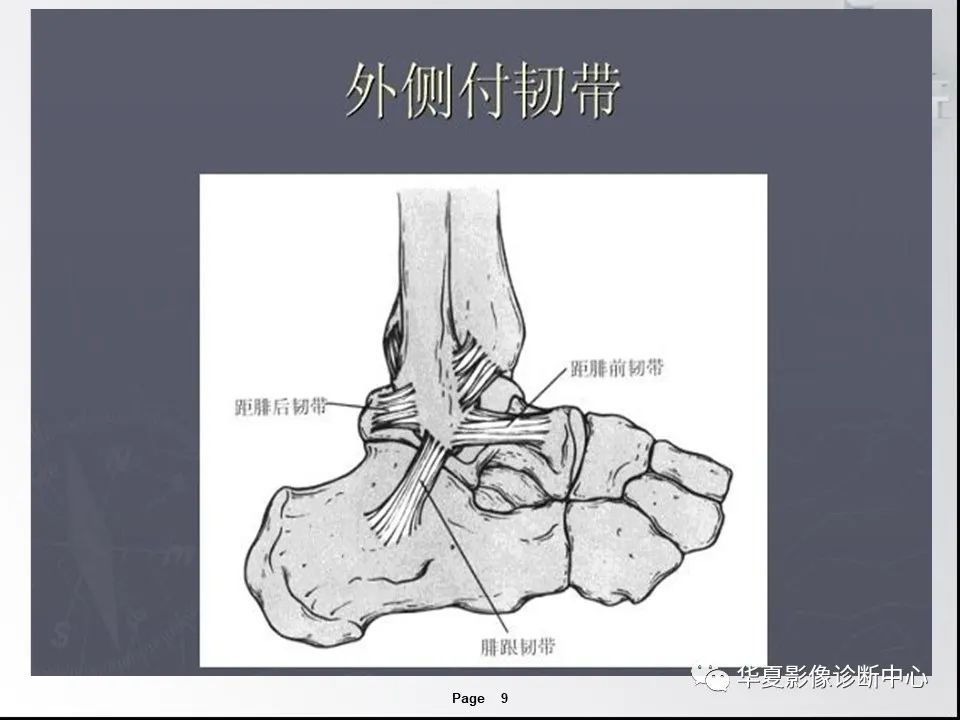 【PPT】踝关节韧带损伤MR表现与损伤机制分析-11
