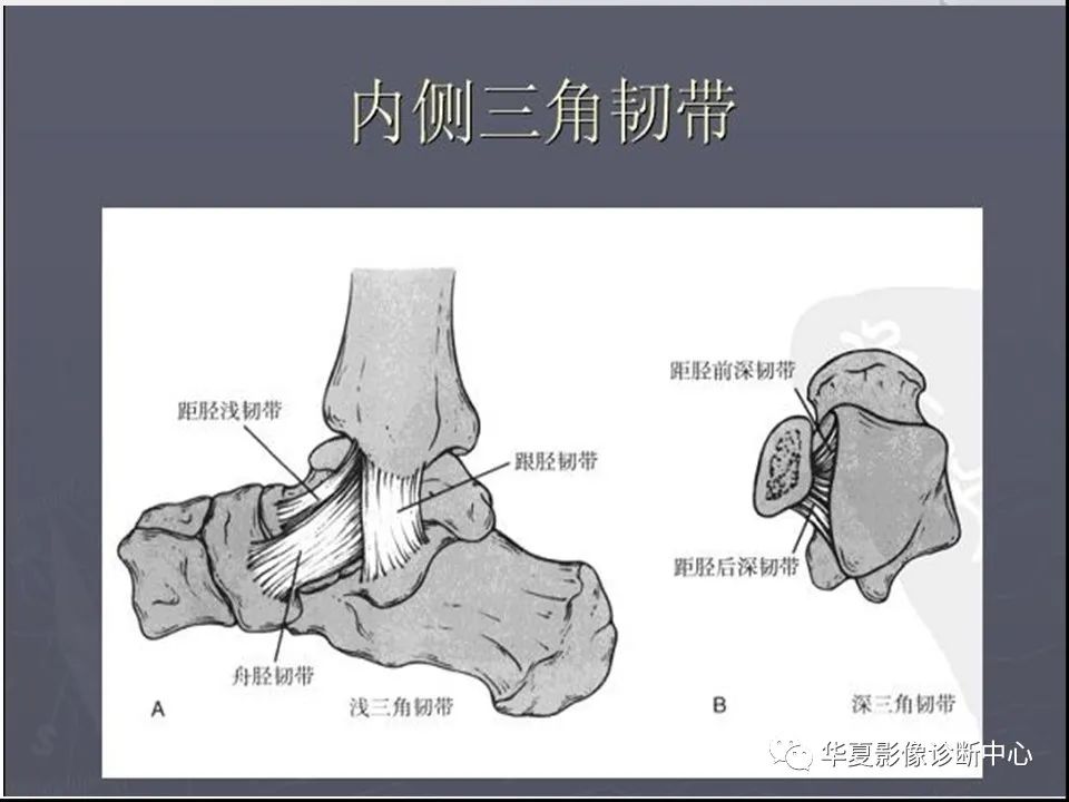 【PPT】踝关节韧带损伤MR表现与损伤机制分析-13