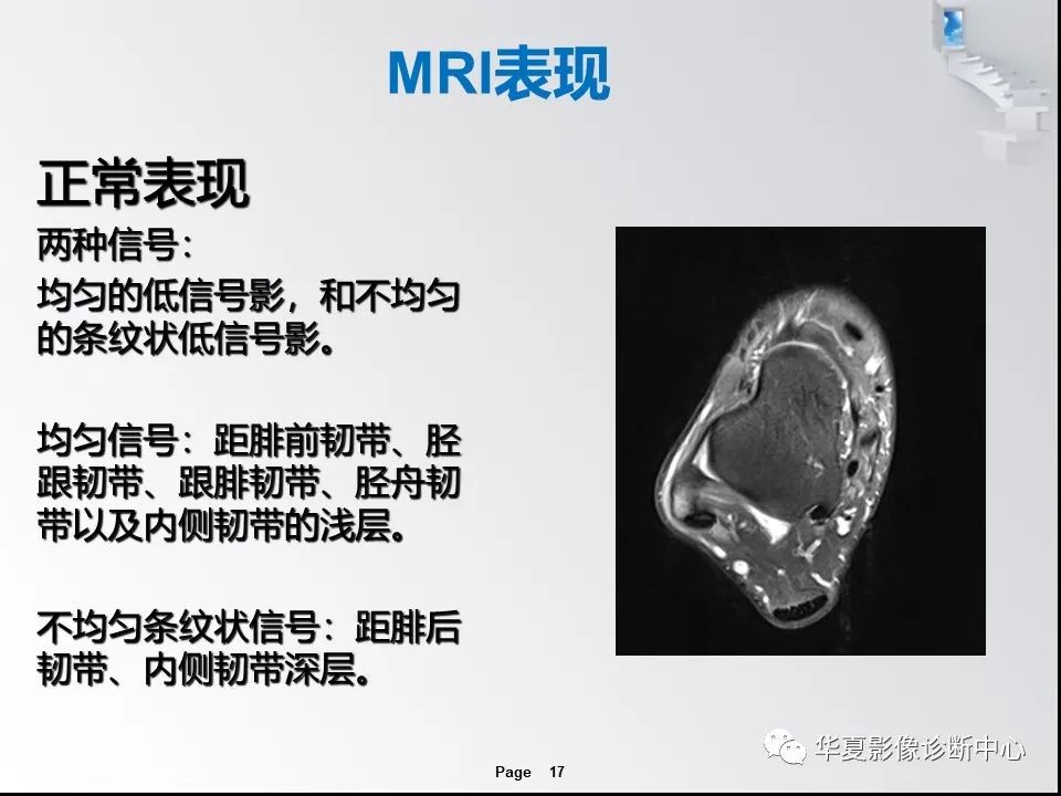 【PPT】踝关节韧带损伤MR表现与损伤机制分析-19