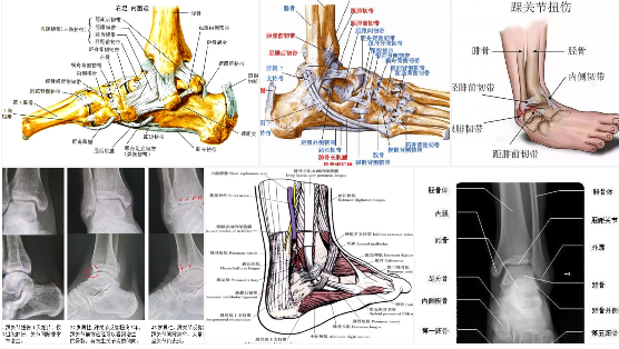 【PPT】踝关节韧带损伤MR表现与损伤机制分析-2