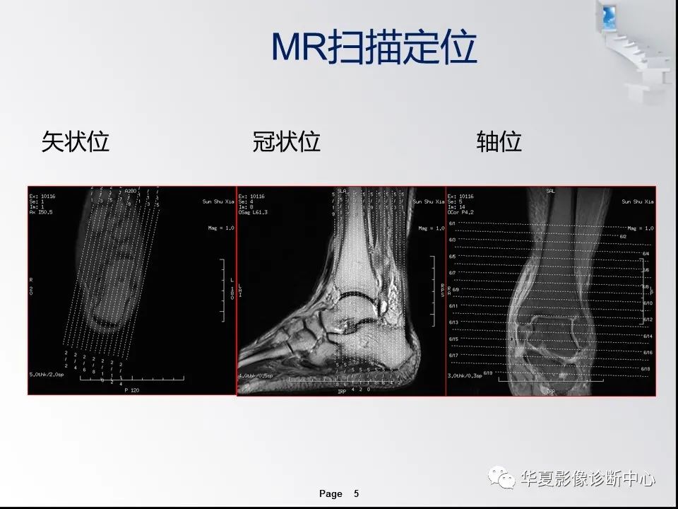 【PPT】踝关节韧带损伤MR表现与损伤机制分析-7
