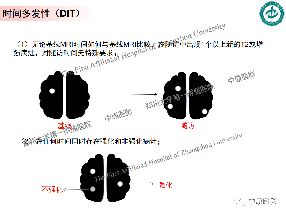 【PPT】视神经脊髓炎与多发性硬化鉴别诊断-22