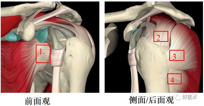 肩关节损伤的影像学诊断-8 肩关节损伤的影像学诊断-8