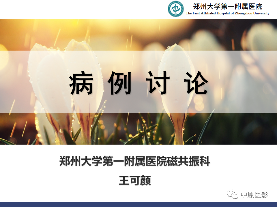 眼眶周围淋巴瘤1例CT及MR