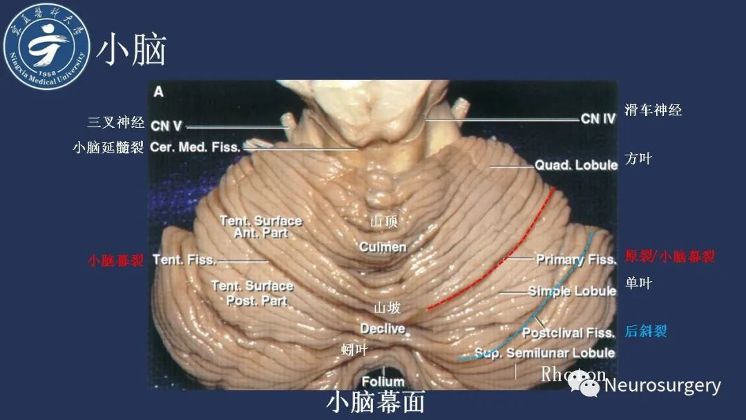 【PPT】小脑解剖-10