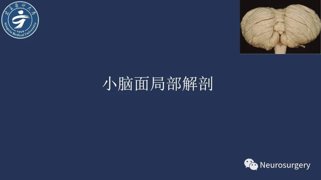 【PPT】小脑解剖-13