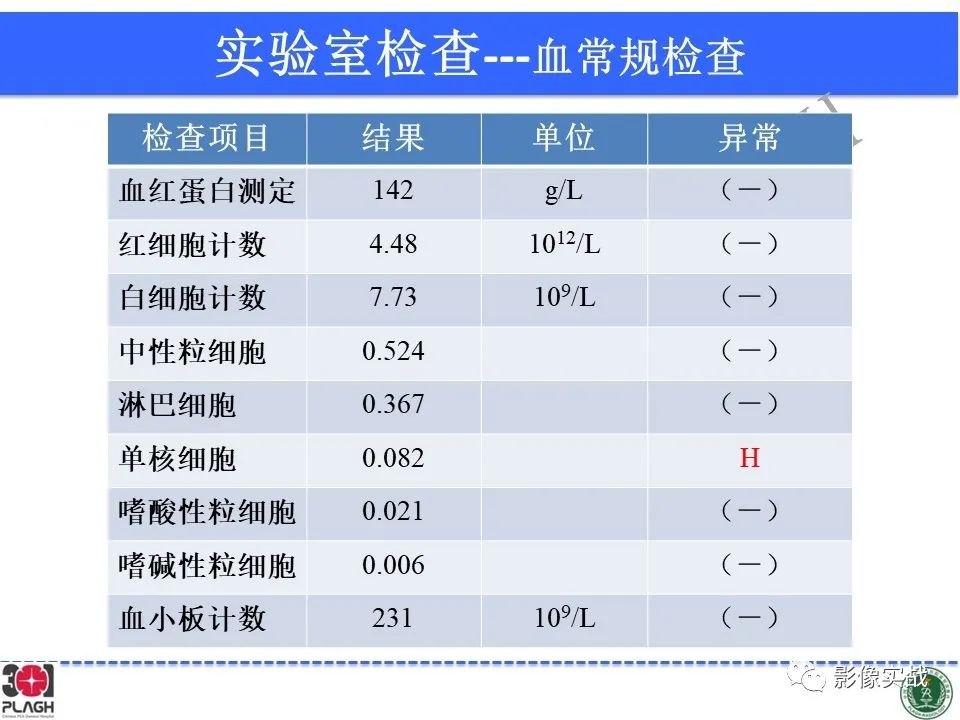 【病例】中枢神经系统生殖细胞肿瘤1例MR-4