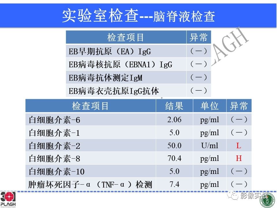 【病例】中枢神经系统生殖细胞肿瘤1例MR-8