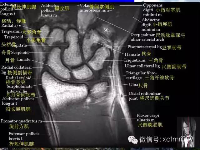 【PPT】腕关节MRI解剖中英对照-9