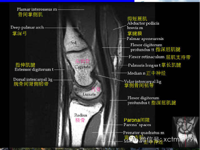 【PPT】腕关节MRI解剖中英对照-23