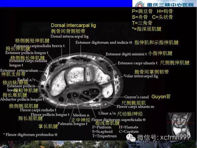 【PPT】腕关节MRI解剖中英对照-41