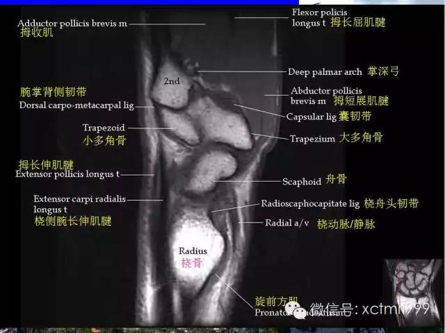 【PPT】腕关节MRI解剖中英对照-27