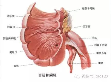 急性阑尾炎的CT诊断