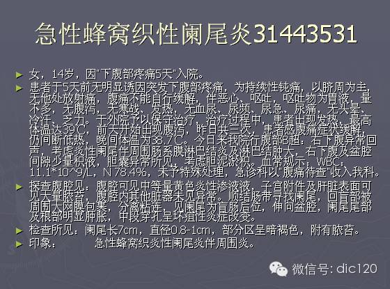 急性阑尾炎的CT诊断