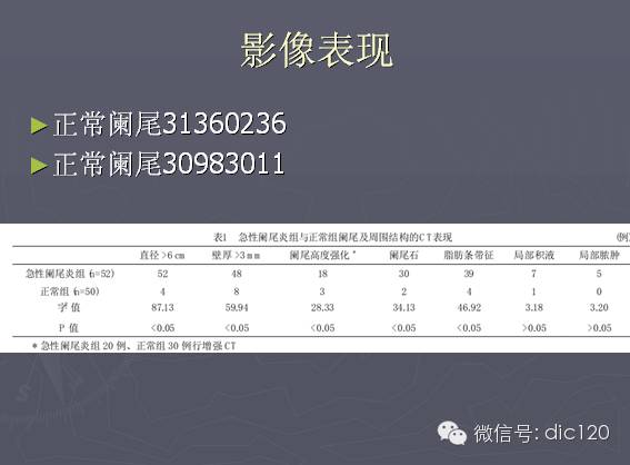 急性阑尾炎的CT诊断