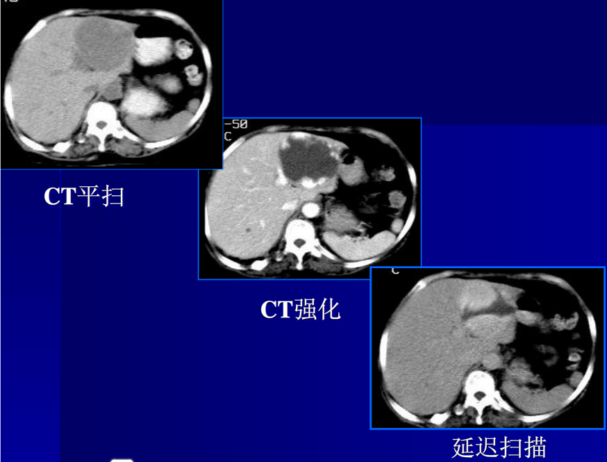 肝胆胰脾影像诊断学