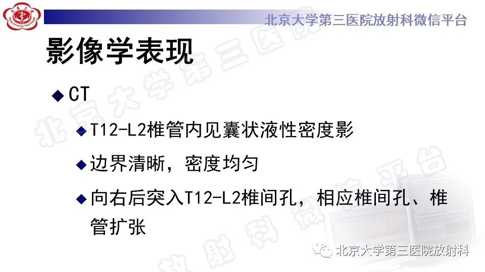 【PPT】椎管内脊膜囊肿-10