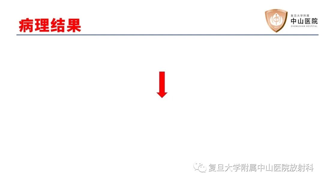 【病例】脊柱骨巨细胞瘤1例CT及MR影像-6