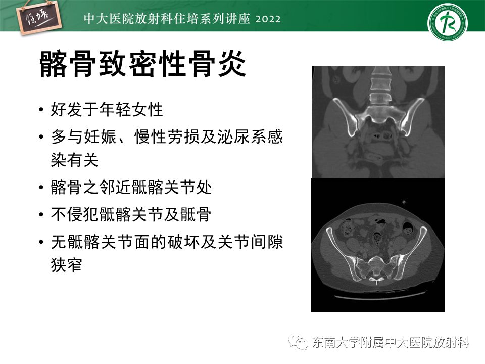 【PPT】脊柱关节炎影像学评估-30