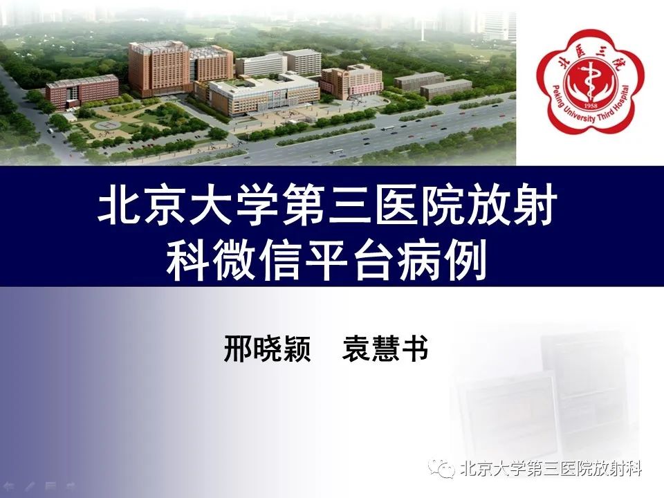 脊柱软骨肉瘤