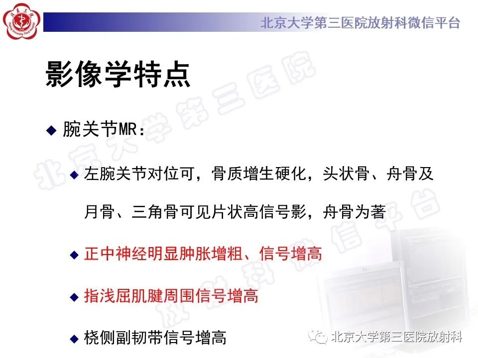 【PPT】腕管综合征-5