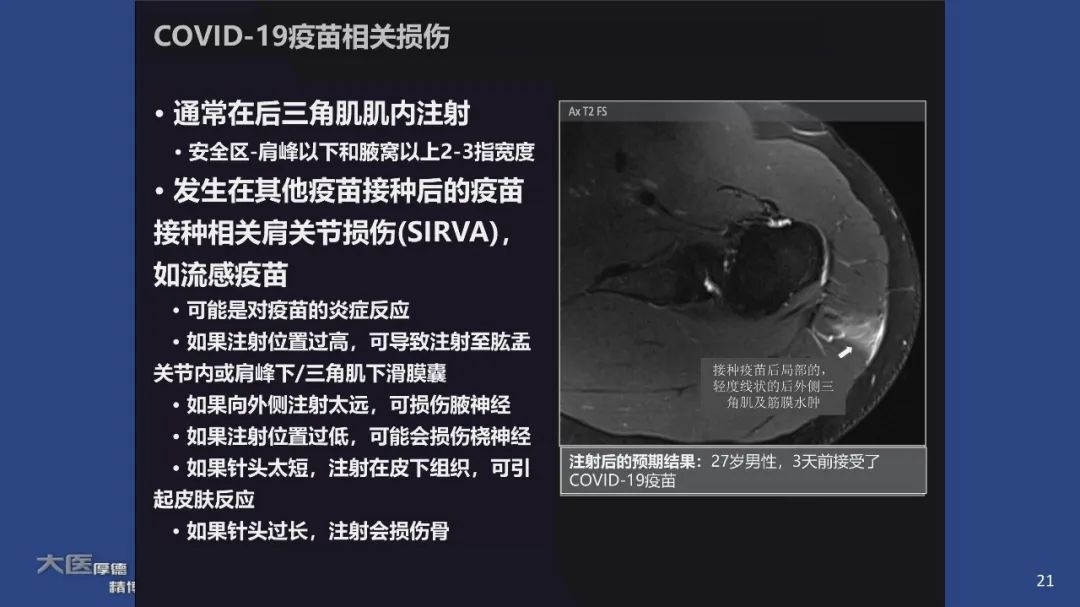 【PPT】COVID-19 的肌肉骨骼表现：对目前所描述的多模态成像及临床症状的图片综述​-19