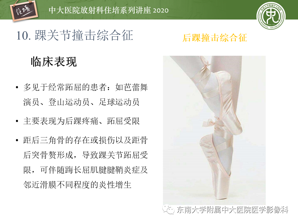 【PPT】常见撞击综合征的影像诊断-62