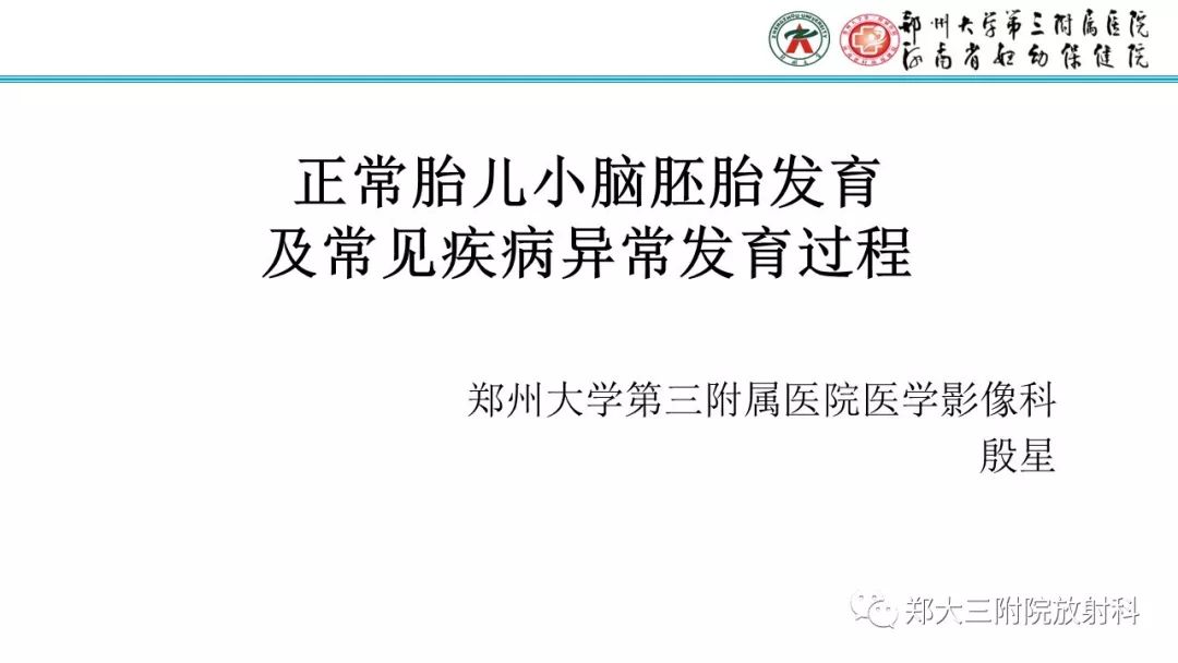胎儿小脑发育及常见疾病的MRI评估